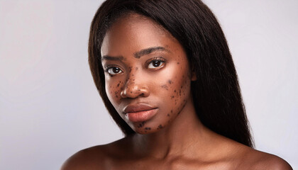 Brown skin with dark spots