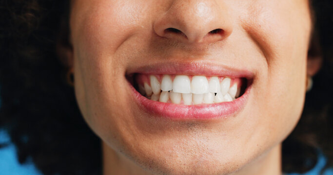 Person, teeth and mouth with smile for dental clean, hygiene or oral and gum care treatment. Closeup, lips and whitening with dentist, results or fresh breathe for invisible braces or plaque removal