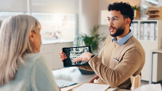Mature woman, doctor and tablet with dental scan for consultation, medical services and orthodontist. People, technology and patient in hospital for appointment, veneers and healthcare with diagnosis
