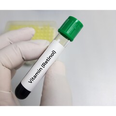 Blood sample for Vitamin A or Retinol test to diagnosis of vitamin A deficiency.