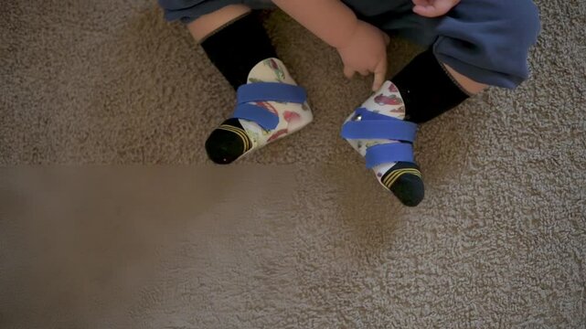 Toddler Wearing Corrective Foot Braces on Carpet toddler sits on carpeted floor wearing colorful corrective foot braces. moment highlights early-childhood care, support, and development.