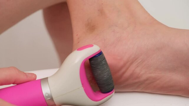 Close-up of electric foot file being used to remove calluses from a heel. Skincare and personal grooming concept. A woman of 40 years old