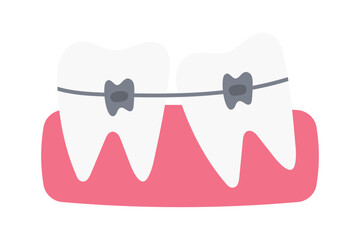 Teeth with braces, vector illustration. Concept of bite correction. Orthodontics.