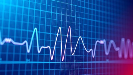 Close-up Cardiogram, High Detail, Vibrant Colors, Professional Medical Art
