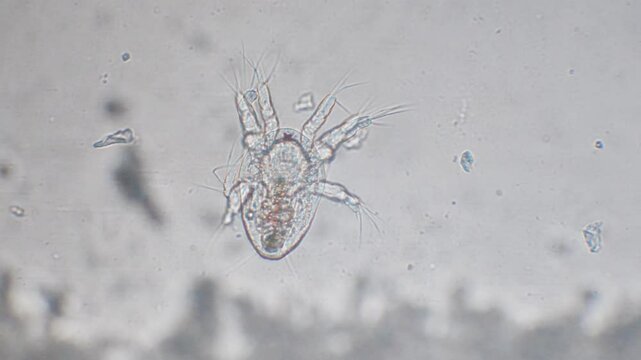 NAUPLIUS OF CYCLOP, CRUSTACEA, microscope, microscopy, frashwater, naupius