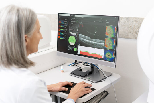 Senior doctor analyzing optical coherence tomography scan on computer in ophthalmology clinic