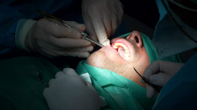 Dental surgeon stitching patient&rsquo;s gum after dental implant placement. Close up