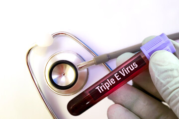 Eastern equine encephalitis (EEE) virus blood sample test. also known as Triple E or sleeping sickness, medical conceptual image.