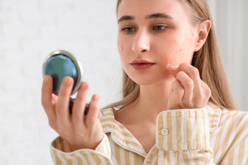 Young woman with acne problem and mirror applying pimple patch in bedroom, closeup
