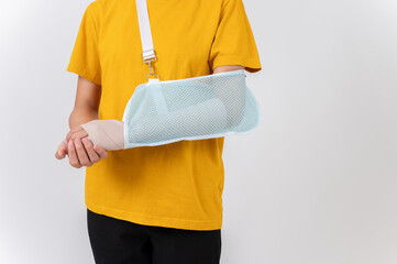 A woman with a broken arm wrapped in a plaster bandage, wearing a sling to support her arm.