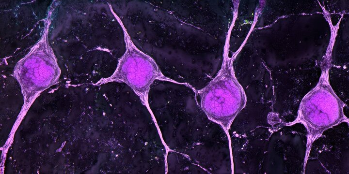 Motor neurons in the anterior horn of the spinal cord, stained with cresyl violet, display pronounced Nissl bodies and prominent nuclei featuring striking nucleoli, highlighting their unique