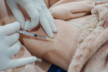 Medical specialist injecting syringe bacterial toxin botulin into armpit for reduce body odor and wrinkles