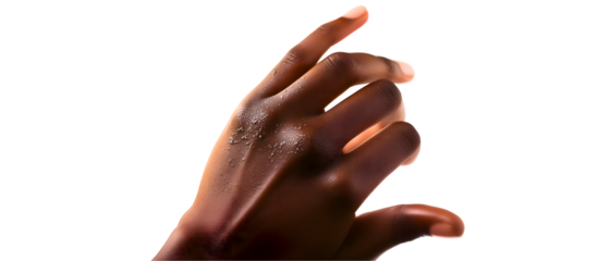 close-up to african woman hand with natural manicure and allergy / skin condition isolated over transparent (white) background