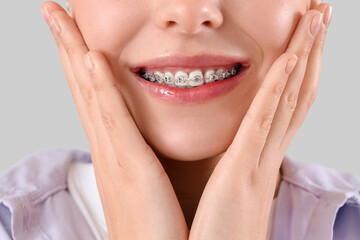 Young woman with dental braces smiling on light background, closeup