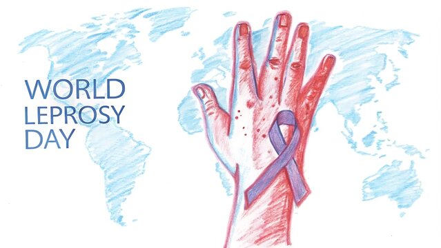 World Leprosy Day. illustration Art