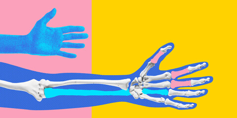 Poster. Contemporary art collage. Blue hand illustration beside skeletal hand with pink and yellow overlay elements against colorful background. Concept of medicine, healthcare, rehabilitation.