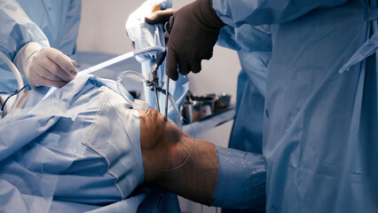The surgeon performs endoscopic manipulations on the kneecap. The doctor performs arthroscopic surgery on the knee or joint in the operating room using modern arthroscopic instruments.