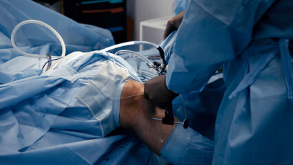 The surgeon performs endoscopic manipulations on the kneecap. The doctor performs arthroscopic...
