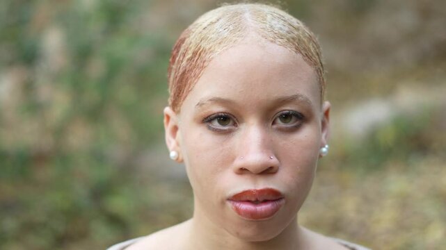 african american albino girl with nystagmus opening her eyes and looking at the camera