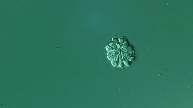 Synura under microscopic view 