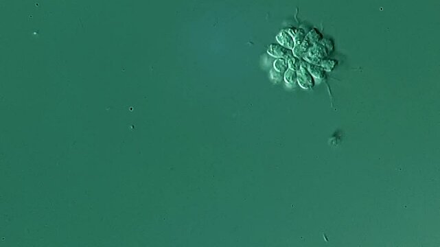 Movement of Synura under DIC microscope 