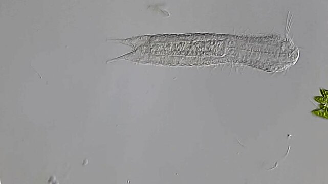 Gastrotrichs and microalgae under microscope 