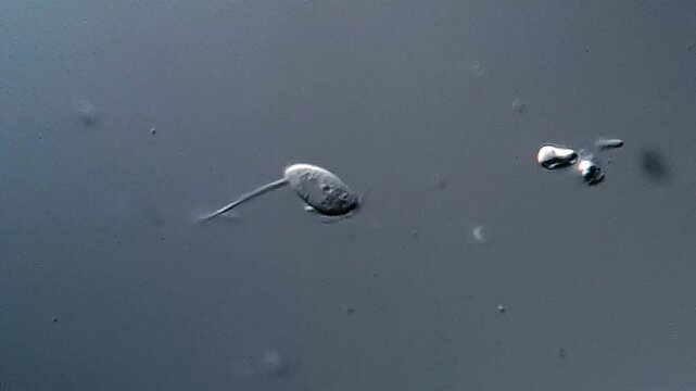 Trichomonas in cat feces under microscope 