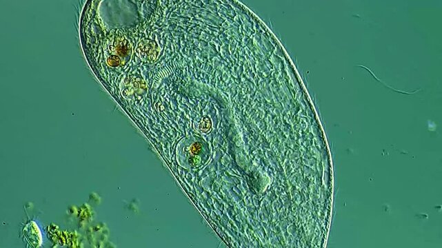 Ciliates under DIC microscope 