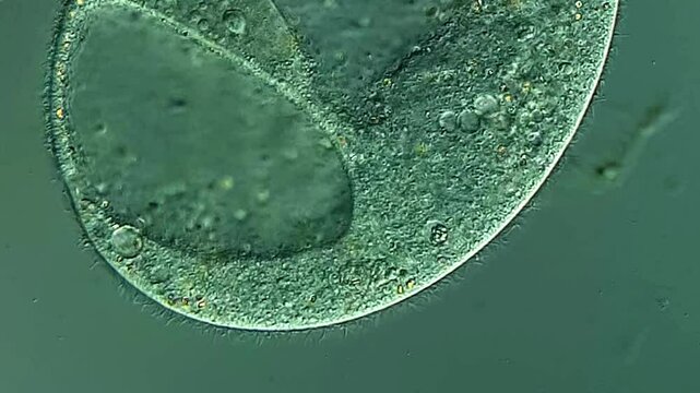 Big Ciliates under DIC microscope 