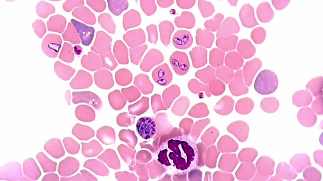 Babesia canis with Wright stain under microscope 