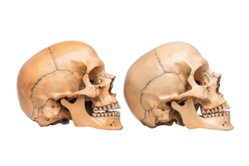 Two skulls are shown side by side, one of which is missing its teeth