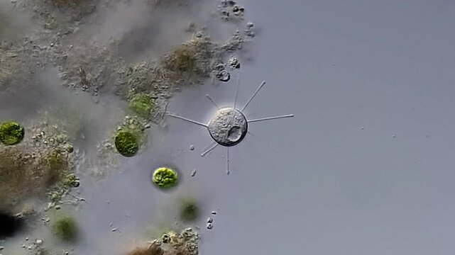 Heliozoa or protist other under microscopy view