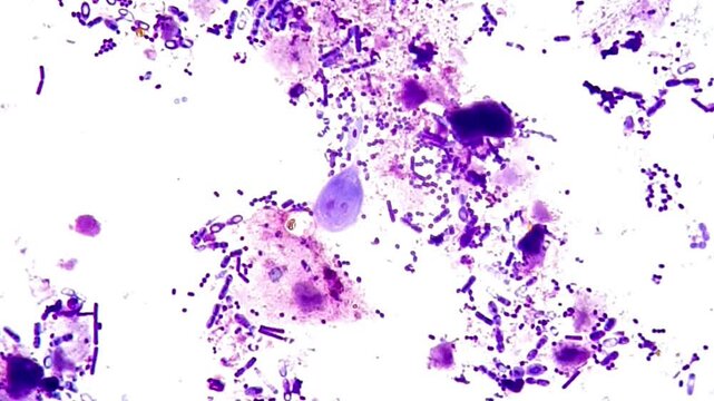 Giardia under microscope 