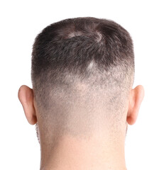 Obraz premium Man suffering from baldness on white background, back view