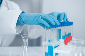 A dedicated scientist is meticulously conducting a fascinating experiment using various test tubes...