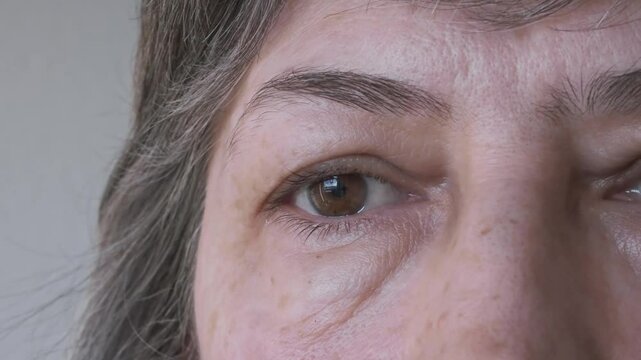 Close-up of a woman's face with grey hair, examining her bags under her eyes and swollen upper eyelids. Concept of plastic surgery of the face, eyelid lift, blepharoplasty, cosmetology, lymphatic drai