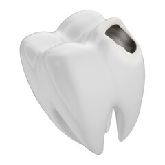 Asset 3D realistic dentist odontologist - White tooth with cavity and decay - Isolated background
