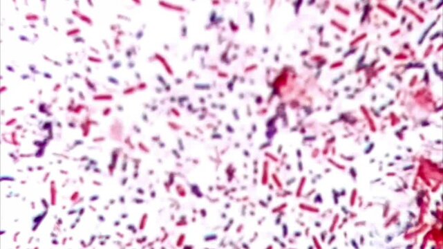 Dog diarrhea bacteria gram stain under microscope 