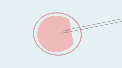 illustration of a needle injecting a sperm cell into an egg on a light blue background, representing in vitro fertilization