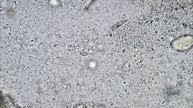 Trichomonas in dogs feces under microscope 