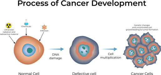 Process of Cancer Development Design Vector Illustration