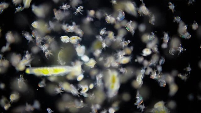 Zooplankton and plankton White Sea under microscope. Various types of larvae Copepoda nauplius, larvae worm Polychaeta, larva Balanus. White sea