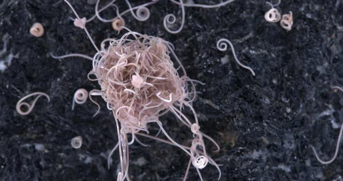 worm Nematoda Pontonema vulgare under microscope, family Oncholaimidae. Found in silted soil, under stones, in algae tangles. White Sea