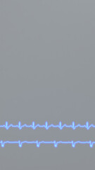 ECG of cardiac arrhythmias. Right bundle branch block and left bundle branch block.