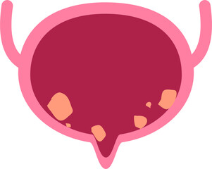 bladder disease. Urinary tract infection Illustration