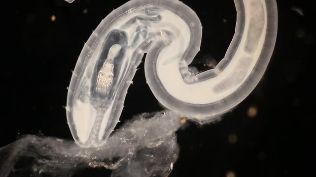 Cyctacanth stage (Acanthocephala) fish cestode larva (Trianchoratus sp.) in Channa striata under the microscope in Lab.