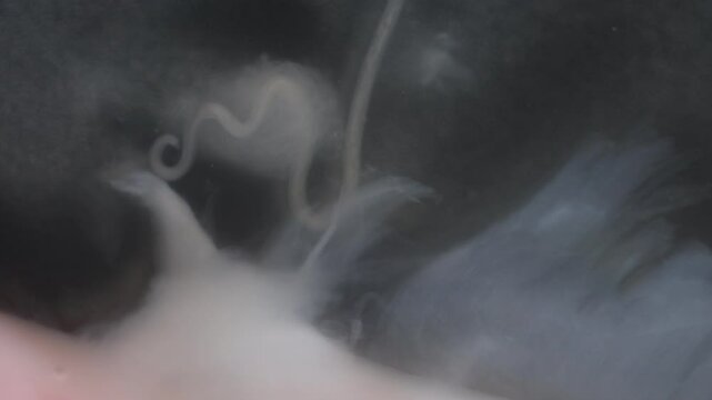 Cyctacanth stage (Acanthocephala) fish cestode larva (Trianchoratus sp.) in Channa striata under the microscope in Lab.