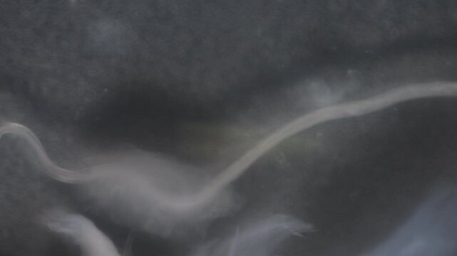 Cyctacanth stage (Acanthocephala) fish cestode larva (Trianchoratus sp.) in Channa striata under the microscope in Lab.