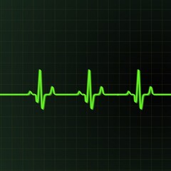 A green electrocardiogram trace runs across a dark grid background, depicting regular heartbeats. The line features sharp peaks and troughs, indicating the rhythm of a heartbeat.
