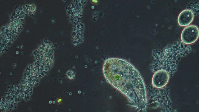 A living unicellular ciliate moves in a liquid among bacteria, a microscope magnification of unicellular animals.